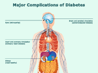 Diabetic Retinopathy Prognosis